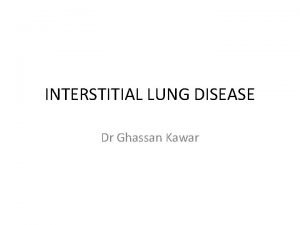 INTERSTITIAL LUNG DISEASE Dr Ghassan Kawar What is