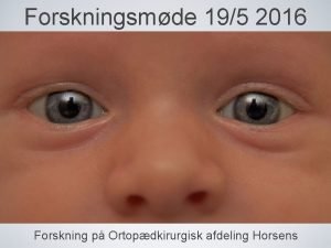 Forskningsmde 195 2016 Forskning p Ortopdkirurgisk afdeling Horsens