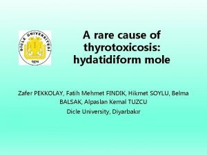 A rare cause of thyrotoxicosis hydatidiform mole Zafer