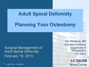 Adult Spinal Deformity Planning Your Osteotomy Surgical Management