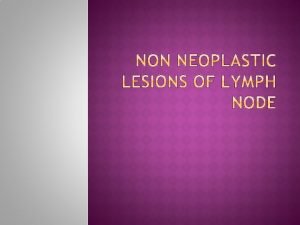 Normal lymph node structure Reactive Non specific lymphadenitis