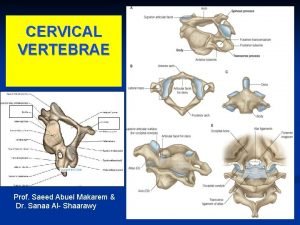 CERVICAL VERTEBRAE Prof Saeed Abuel Makarem Dr Sanaa