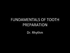FUNDAMENTALS OF TOOTH PREPARATION Dr Rhythm Primary retention