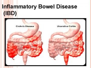 Inflammatory Bowel Disease IBD The main objectives of