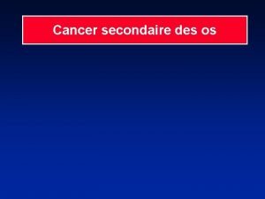 Cancer secondaire des os Frquence des mtastases osseuses