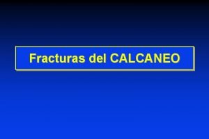 Fracturas del CALCANEO Fracturas del CALCANEO Calcaneo vista