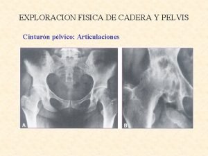 Exploracion fisica de cadera y pelvis