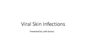 Viral Skin Infections Presented by Laith Sorour Herpes