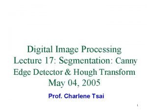 Digital Image Processing Lecture 17 Segmentation Canny Edge