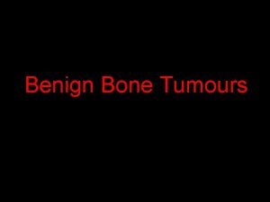 Benign Bone Tumours Normal Anatomy diaphysis cortex metaphysi