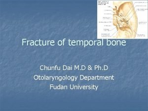 Fracture of temporal bone Chunfu Dai M D