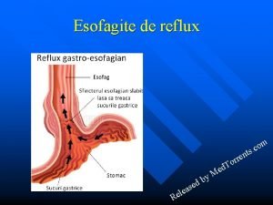 Esofagite de reflux en r r o d