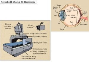 Photo spot camera in fluoroscopy