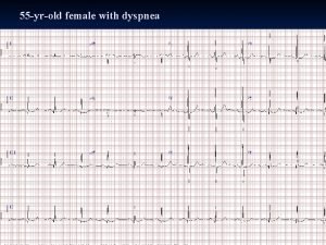 55 yrold female with dyspnea Interpretation SR with