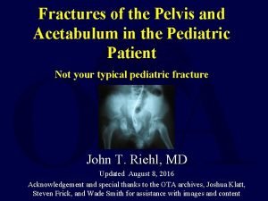 Fractures of the Pelvis and Acetabulum in the