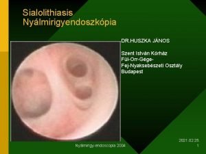 Sialolithiasis Nylmirigyendoszkpia DR HUSZKA JNOS Szent Istvn Krhz