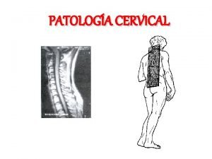 PATOLOGA CERVICAL ANAMNESIS El dolor en el cuello