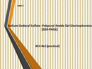 Lab 4 Sodium Dodecyl Sulfate Polyacryl Amide Gel