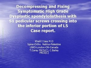 Decompressing and Fixing Symptomatic High Grade Dysplastic spondylolisthesis