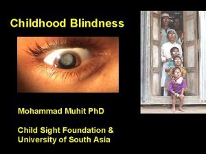 Childhood Blindness Mohammad Muhit Ph D Child Sight