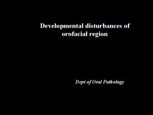 Developmental disturbances of orofacial region Dept of Oral