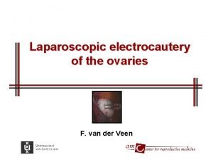 Laparoscopic electrocautery of the ovaries F van der