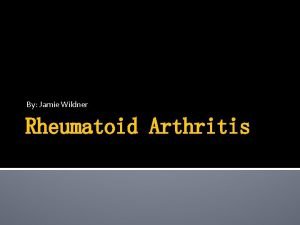 By Jamie Wildner Rheumatoid Arthritis Table of Contents