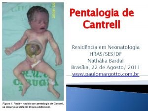 Pentalogia de Cantrell Residncia em Neonatologia HRASSESDF Nathlia