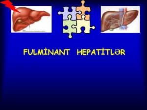 Fulminant hepatit