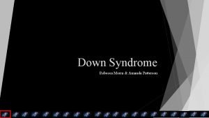 Dandywalker syndrome treatment market