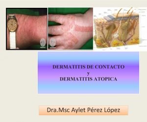 DERMATITIS DE CONTACTO y DERMATITIS ATOPICA Dra Msc