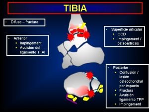 TIBIA Difuso fractura Superficie articular OCD Impingement osteoartrosis