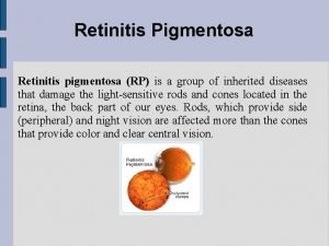 Retinitis Pigmentosa Retinitis pigmentosa RP is a group