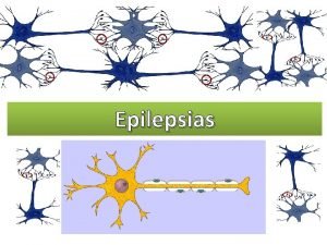 Epilepsias SINDROME CONVULSIVO EPILEPSIA y ESTADOS DE CONCIENCIA