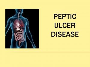 PEPTIC ULCER DISEASE The lesion of peptic ulcer
