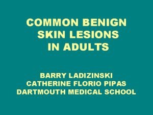 COMMON BENIGN SKIN LESIONS IN ADULTS BARRY LADIZINSKI