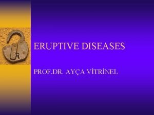 ERUPTIVE DISEASES PROF DR AYA VTRNEL MEASLES Measles