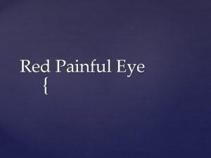 Red Painful Eye Anatomy Red painfull Eye 1