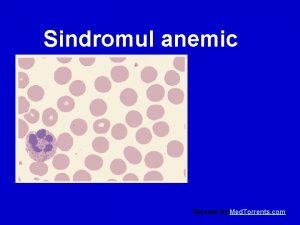 Sindromul anemic