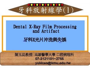 X-ray film processing
