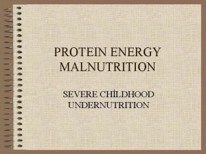 Water law classification of malnutrition