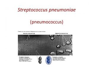 Streptococcus pneumoniae pneumococcus Streptococcus pneumoniae Classic example of