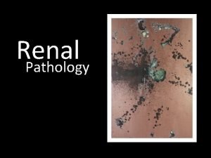 Benign nephrosclerosis pathology outlines