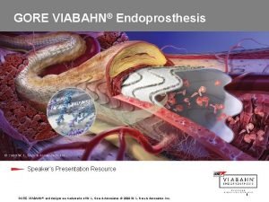 GORE VIABAHN Endoprosthesis Speakers Presentation Resource GORE VIABAHN
