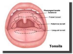 Where are the tonsils located
