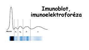 Imunoblot imunoelektroforza Jana varcov Plazmatick proteiny http slideplayer