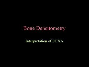 Bone Densitometry Interpretation of DEXA Osteoporosis is the