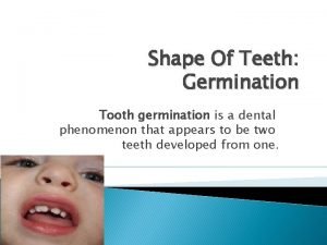 Shape Of Teeth Germination Tooth germination is a