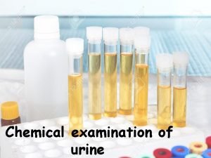 Chemical examination of urine Routine chemical examination of