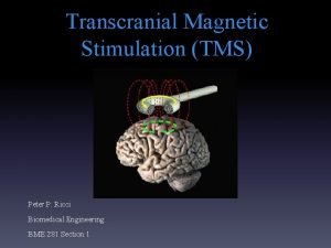 Transcranial Magnetic Stimulation TMS Peter P Ricci Biomedical